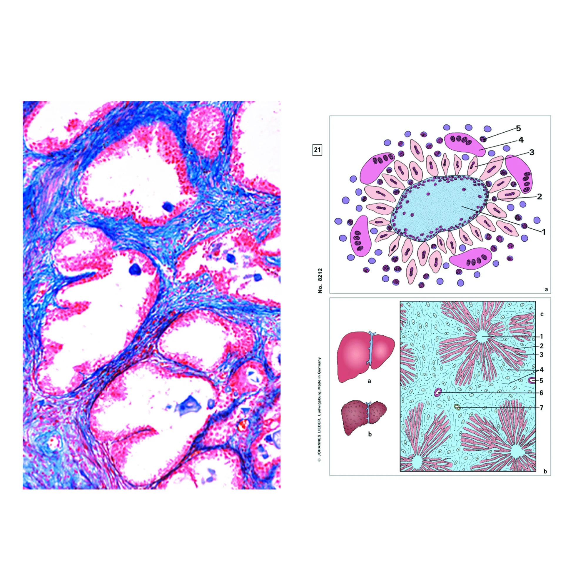 Maladies de l'homme (pathologie), base (6 préparations), kit étudiant
