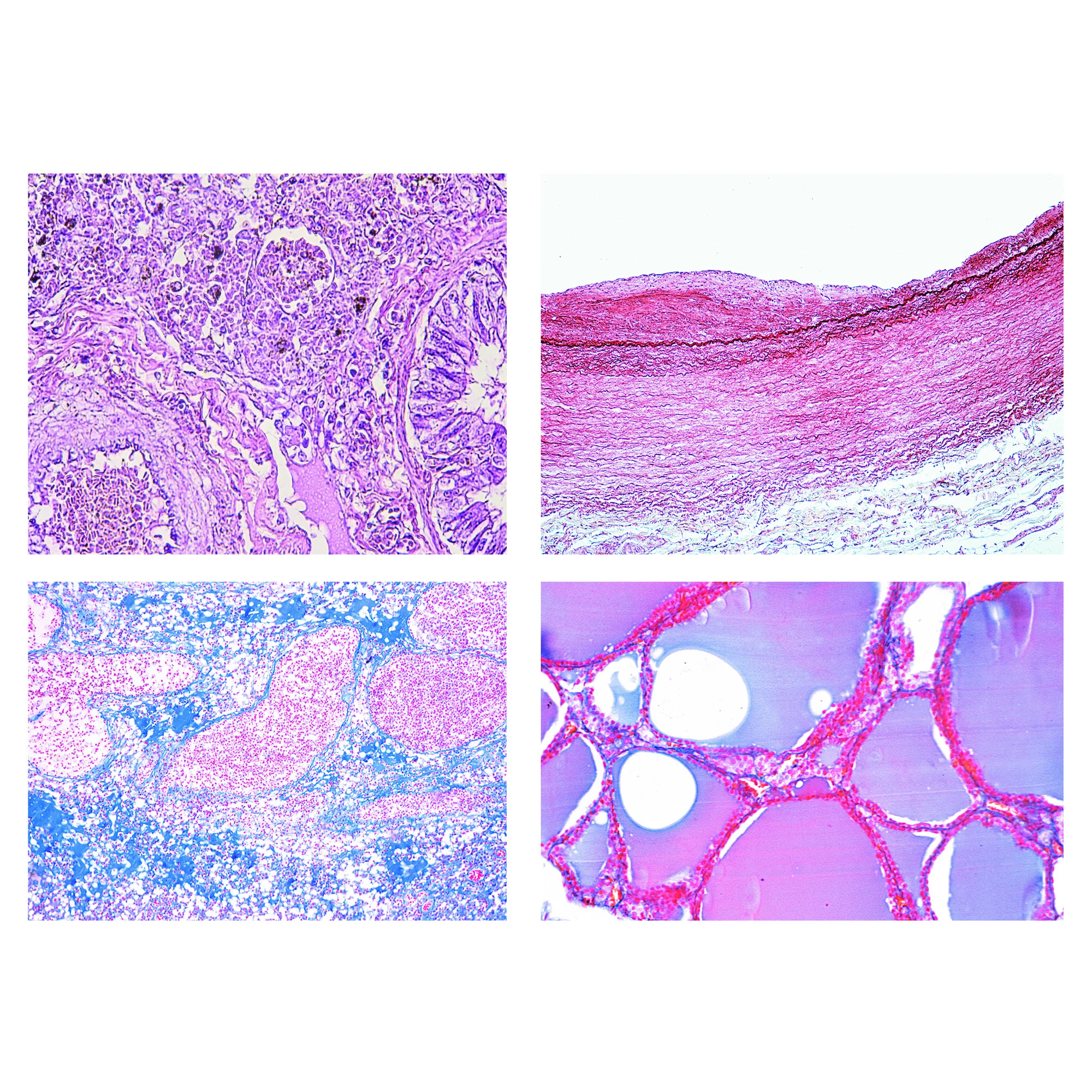 Histologie pathologie humaine, petite série (50 préparations)
