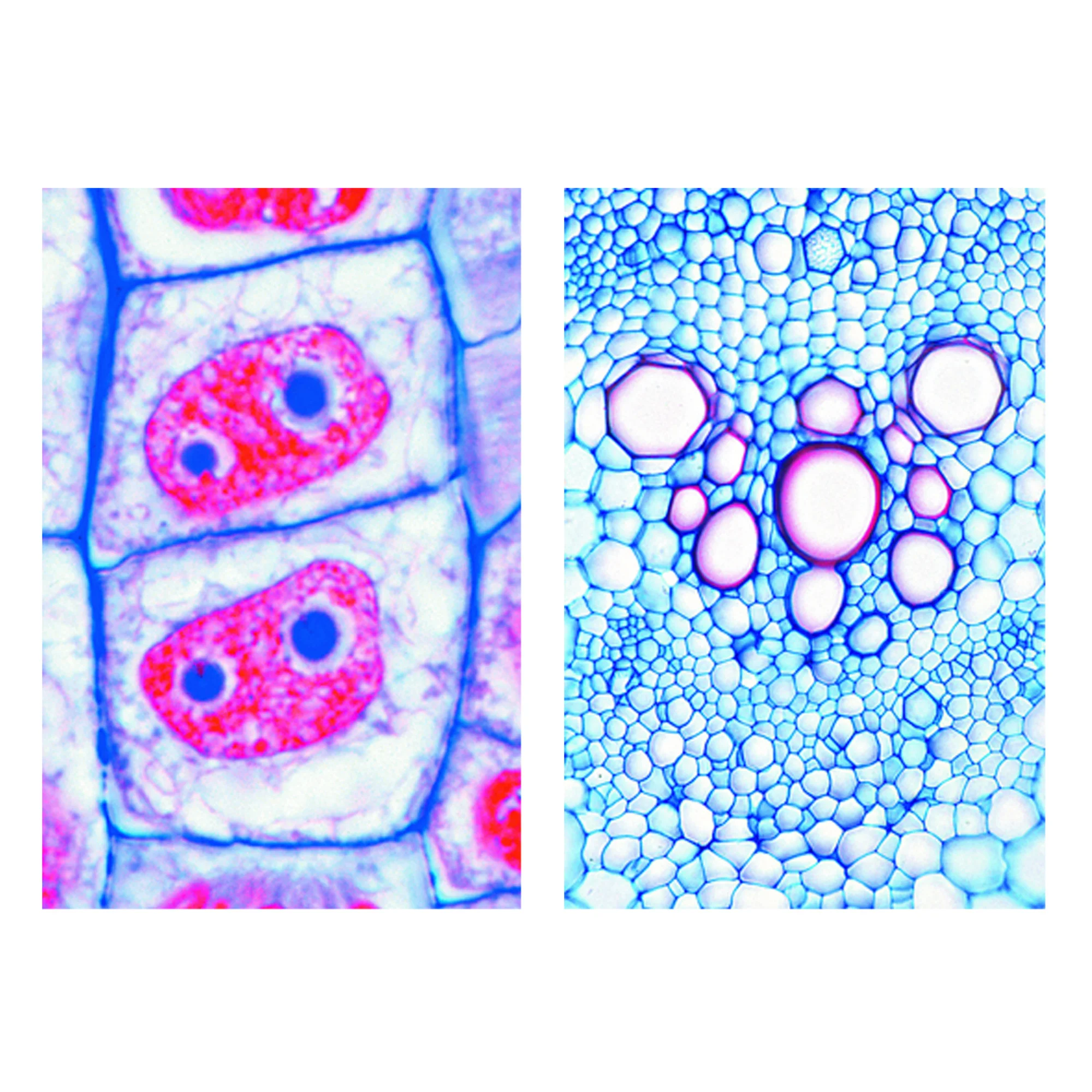 Cellule végétale (cytologie), base (6 préparations), kit étudiant