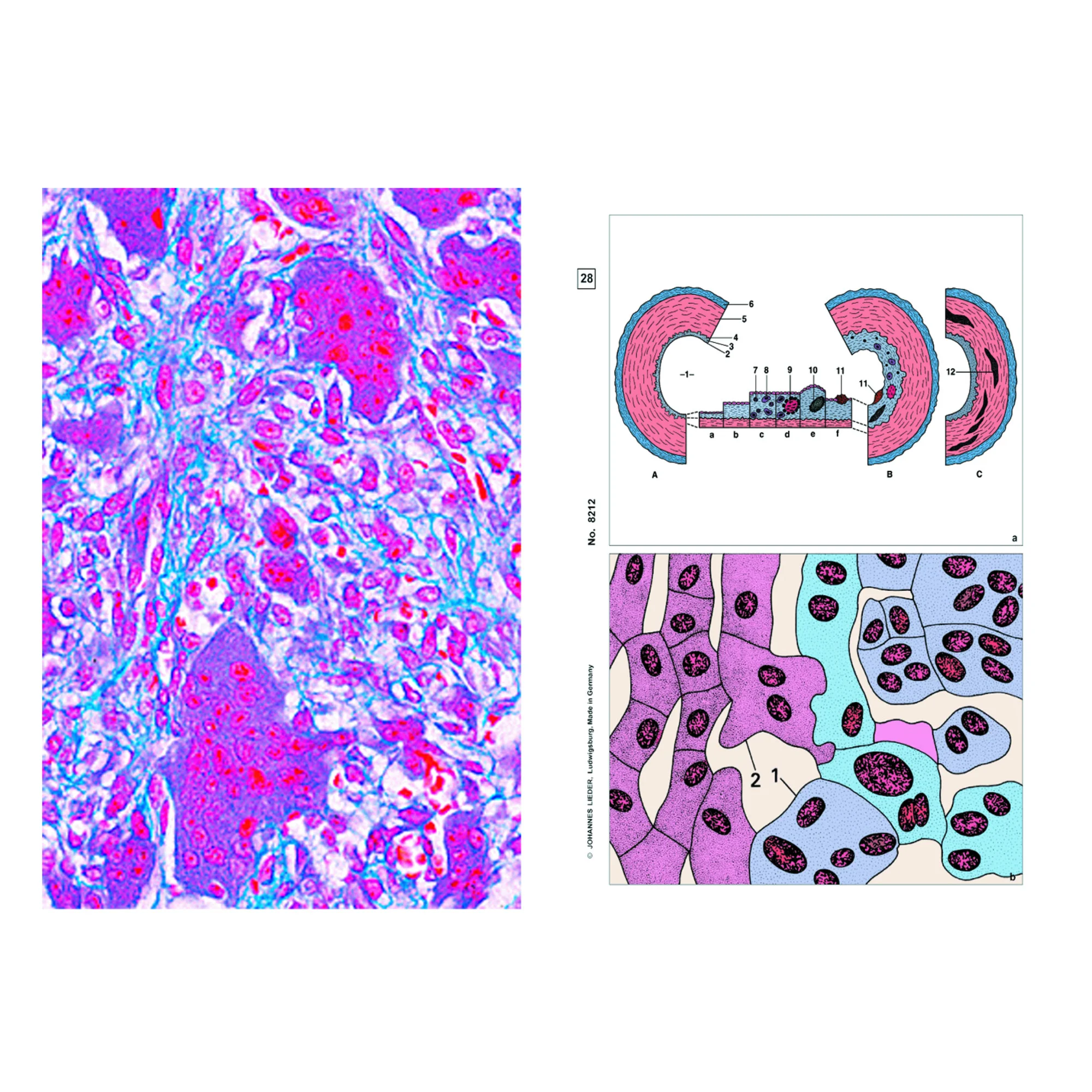Maladies de l'homme (pathologie), complément (12 préparations), kit étudiant